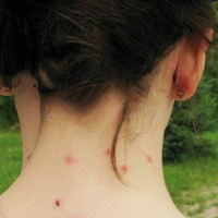 Khenifra, Les moustiques attaquent !, Le Matin
