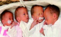Naissance de quintuplés